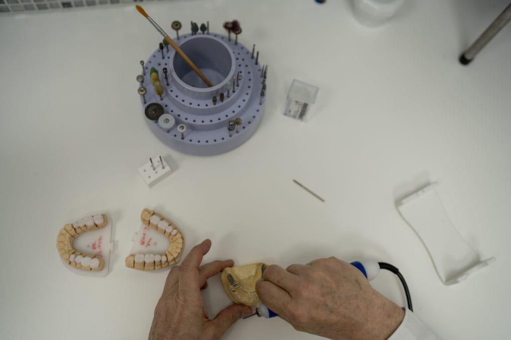 Zahnersatz Modell bei dental gallery